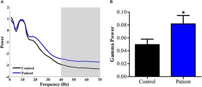 Elevated Resting State Gamma Oscillatory Activities in Electroencephalogram of Patients With Post-herpetic Neuralgia